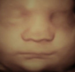 3D ultrasound image of baby