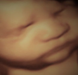 3D ultrasound image of baby